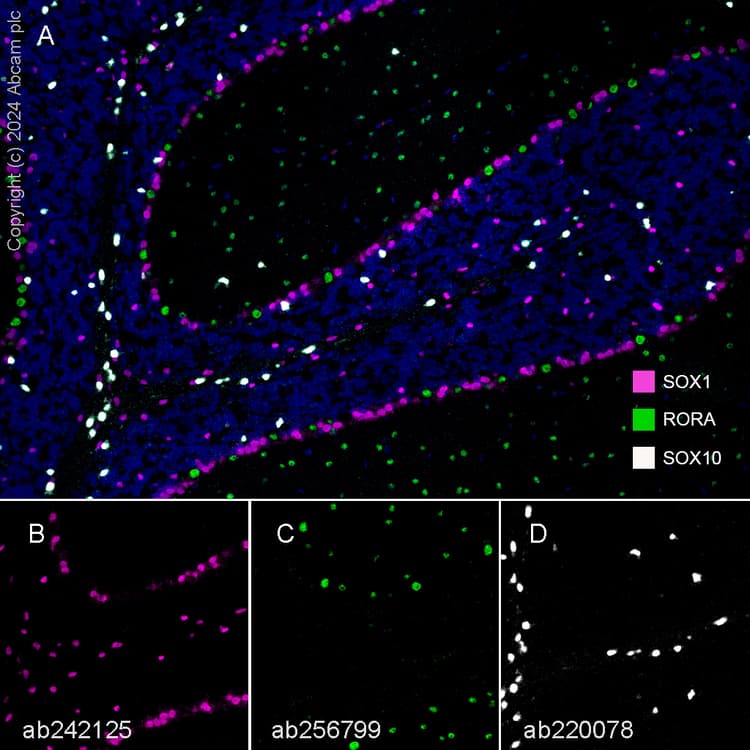 Sox1 Antibody Epr23041 60 Bsa And Azide Free Ab263870  Multiplex Immunohistochemistry Img434342