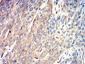 Atg3 Antibody 7a1d1 Ab233560  Immunohistochemistry Formalin Pfa Fixed Paraffin Embedded Sections Img117945