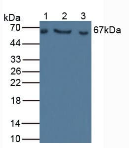 Anti-Factor I/CFI antibody(AB231969)