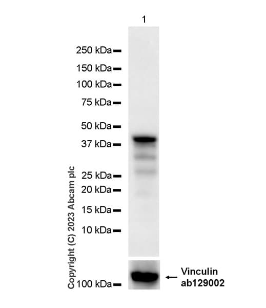 Anti-FOXF1 antibody [EPR27368-79](AB308633)