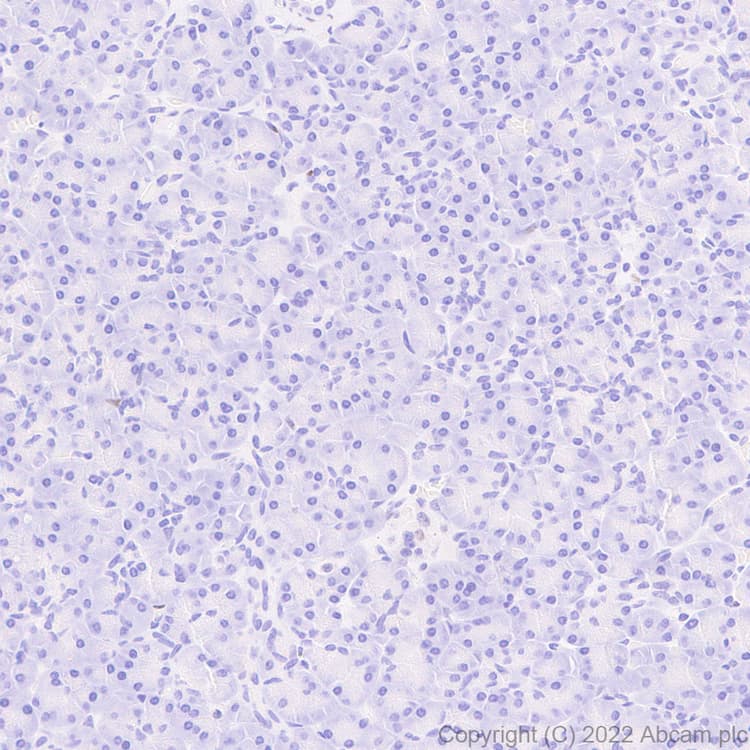 Anti-IKKi/IKKe+NAK/TBK1 antibody [EPR25258-15](AB289973)