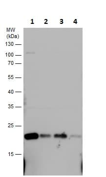 Anti-SOD2/MnSOD antibody(AB227091)