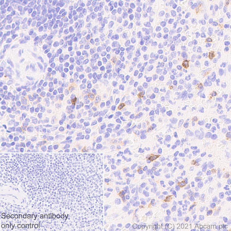 Anti-IL2 Receptor beta/p75 antibody [EPR24336-29](AB271040)