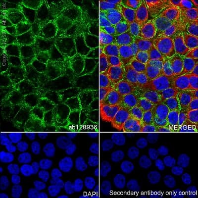 Anti-Syndecan-1 antibody [EPR6454](AB128936)