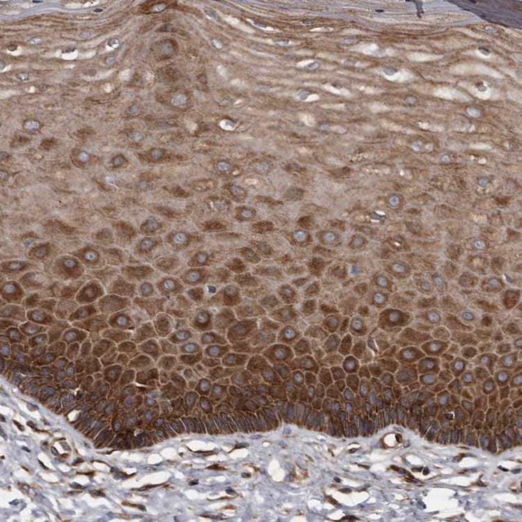 Kctd20 Antibody Ab122094  Immunohistochemistry Formalin Pfa Fixed Paraffin Embedded Sections Img119157