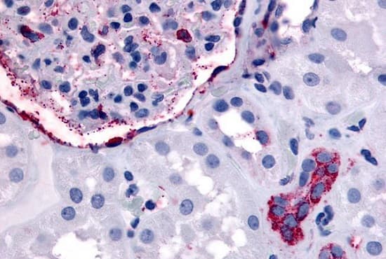 Anti-ErbB4 / HER4 antibody(AB230781)