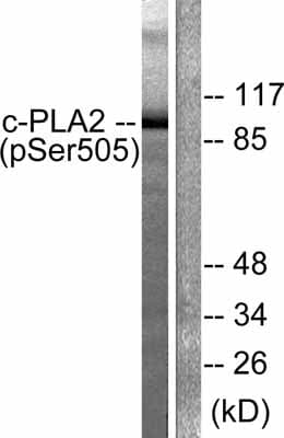 Cytosolic Phospholipase A2 Phospho S505 Antibody Ab53105  Western Blot Img7681