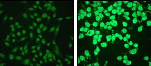 Cleaved Caspase 3 Antibody E83 77 Bsa And Azide Free Ab208003  Immunocytochemistry Immunofluorescence Img133661