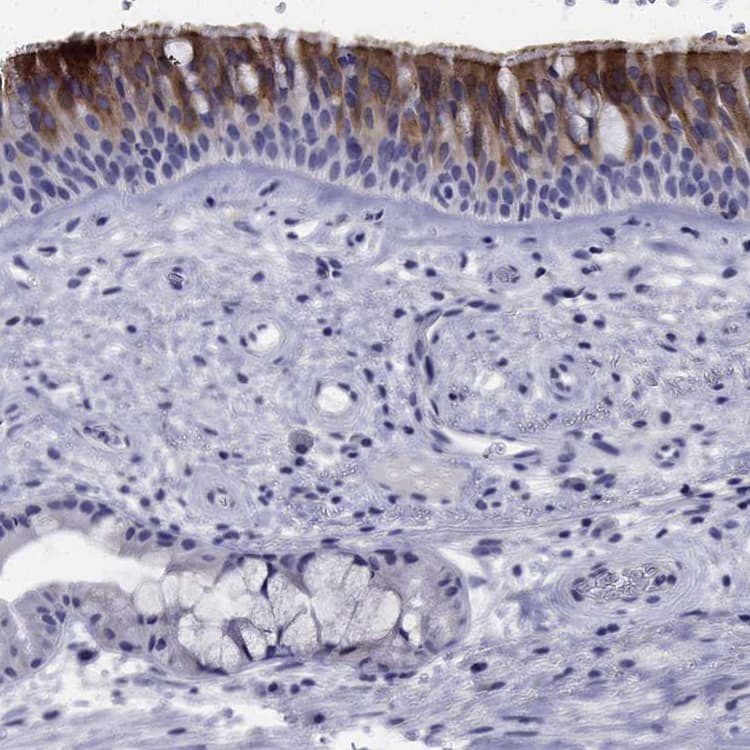Flj23834 Antibody Ab121337  Immunohistochemistry Formalin Pfa Fixed Paraffin Embedded Sections Img96668