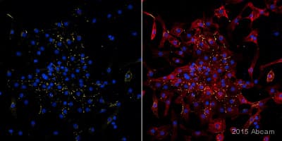 Anti-Connexin 43 / GJA1 antibody - Intercellular Junction Marker(AB11370)