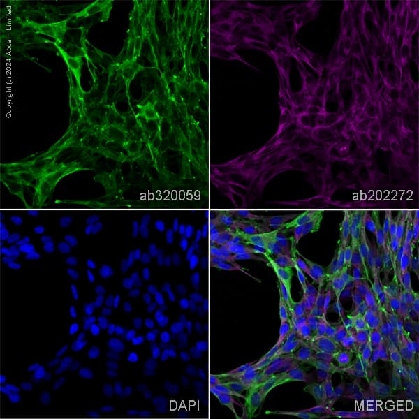 Alexa Fluor 594 Alpha Tubulin Antibody Ep1332y Microtubule Marker Ab202272  Immunocytochemistry Immunofluorescence Img433960