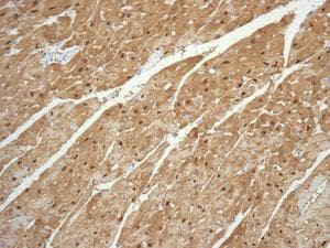 Anti-S100 alpha antibody [EPR5250](AB133519)