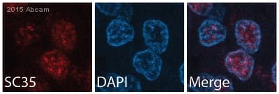 Anti-SC35 antibody [SC-35] - Nuclear Speckle Marker(AB11826)