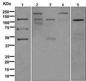 C3 C3a Antibody Epr29872abcb Ab171080  Western Blot Img104804