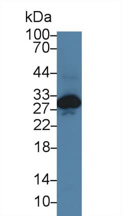 Anti-Cardiac Troponin I antibody(AB231064)