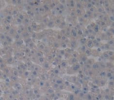 Factor B Antibody Ab231072  Immunohistochemistry Formalin Pfa Fixed Paraffin Embedded Sections Img17422