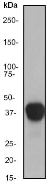 Anti-HLA A antibody [EP1395Y](AB52922)