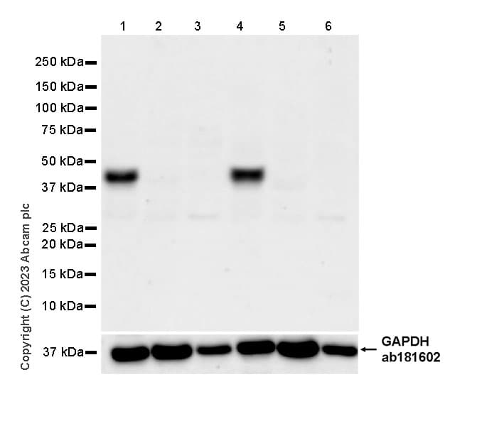 Anti-MATH2/NEUROD6 antibody [EPR28660-23](AB315812)