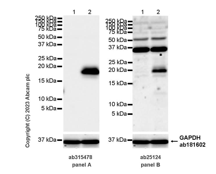 Anti-MCP1 antibody [RM1100](AB315478)