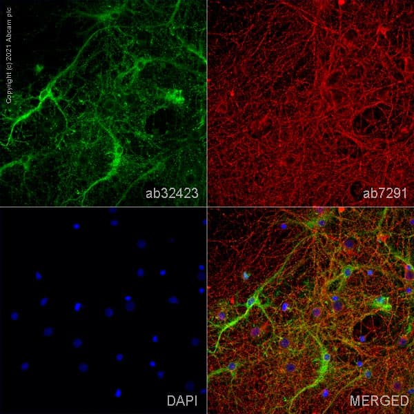 Anti-BLBP antibody(AB32423)