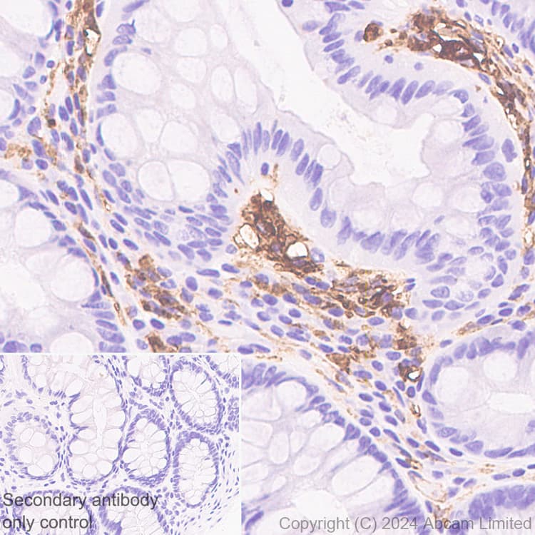 Anti-HLA DR + DP + DQ antibody [CR3/43](ab7856)