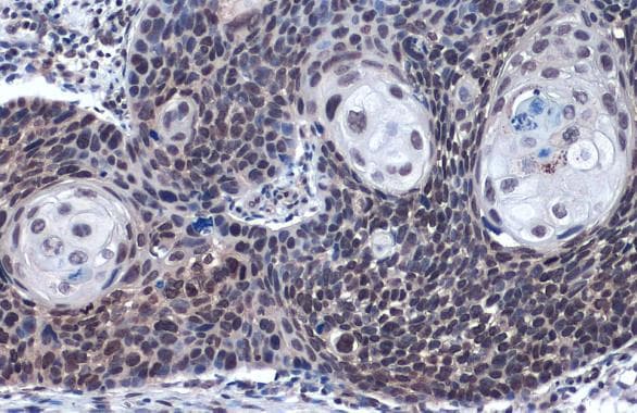 Loxl2 Antibody Ab96233  Immunohistochemistry Formalin Pfa Fixed Paraffin Embedded Sections Img117197