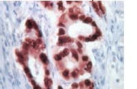 Rabbit specific HRP/Dab Detection IHC Kit(ab64261)