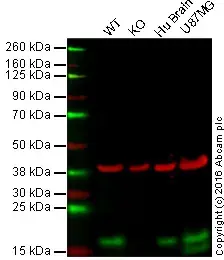 Anti-LC3B antibody [EPR18709] - Autophagosome Marker(AB192890)