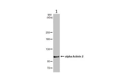 Anti-Sarcomeric Alpha Actinin antibody(AB137346)