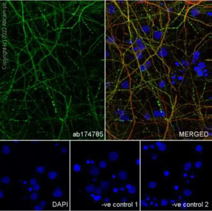 Goat Anti-Rabbit IgG H&L (Alexa Fluor® 594)(AB150080)