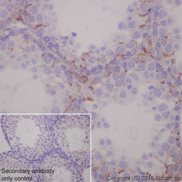 Anti-Niemann Pick C2 antibody [EPR19993] - BSA and Azide free(AB271975)