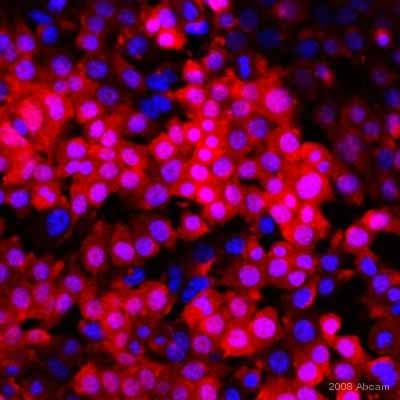 Anti-Firefly Luciferase antibody(AB21176)