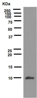 Anti-S100P antibody [EPR6142](AB124743)
