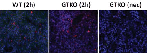 Anti-C5b-9 + C5b-8 antibody [aE11](AB66768)