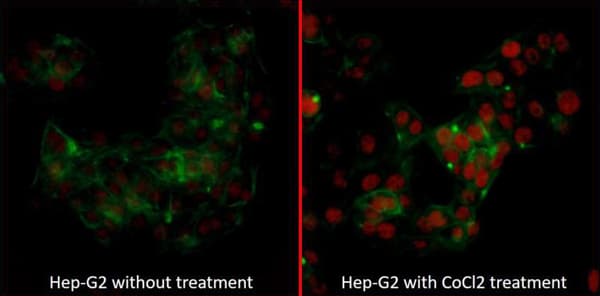 Anti-HIF-2-alpha antibody [BL-95-1A2](AB243861)