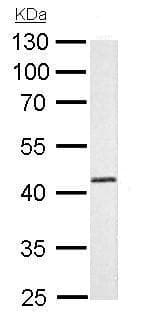Anti-ADK antibody(AB227087)