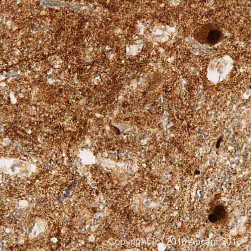 Alpha Synuclein Antibody Mjfr1 Bsa And Azide Free Ab209420 Immunohistochemistry Formalin Pfa Fixed Paraffin Embe I1sHBrypFj