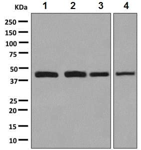 Anti-HOXA5 antibody [EPR2825(2)] - BSA and Azide free(AB248919)