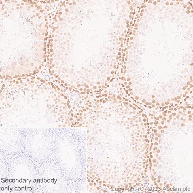 Anti-METTL16 antibody [EPR27236-78](AB313743)