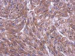 Rpl4 Antibody Ab154907  Immunohistochemistry Formalin Pfa Fixed Paraffin Embedded Sections Img86227