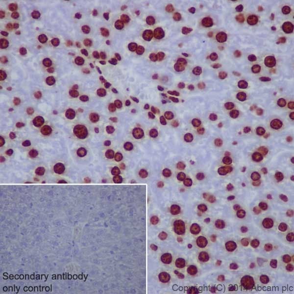Anti-Histone H3 (tri methyl K9) antibody [EPR16601] - ChIP Grade(AB176916)