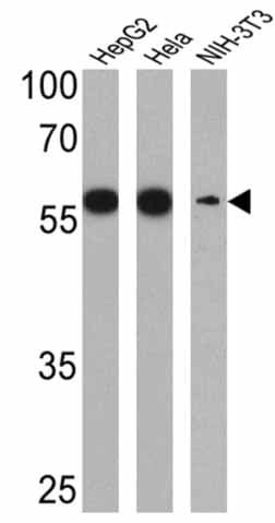 Anti-P4HB antibody [RL90](AB2792)