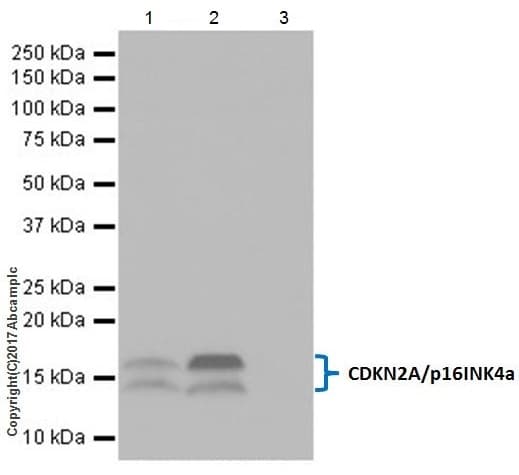 Anti-CDKN2A/p16INK4a antibody [EPR20418](AB211542)