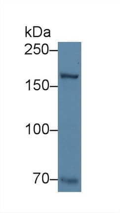 Anti-Collagen XVII antibody(AB231939)