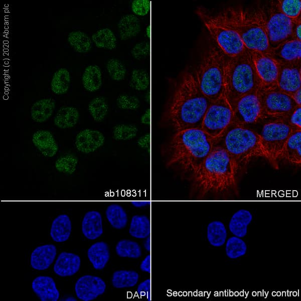Anti-Transcription factor AP-2-alpha antibody [EPR2688(2)](AB108311)