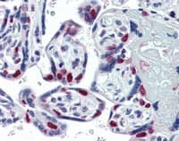 Anti-PARP1 antibody [A6.4.12](AB110915)