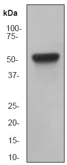 Anti-Cytokeratin 8 antibody [EP1628Y] - Cytoskeleton Marker(AB53280)