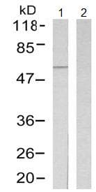 Anti-CaMKII alpha antibody(AB131468)