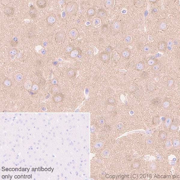 Anti-beta 2 Adrenergic Receptor antibody [EPR707(N)](AB182136)