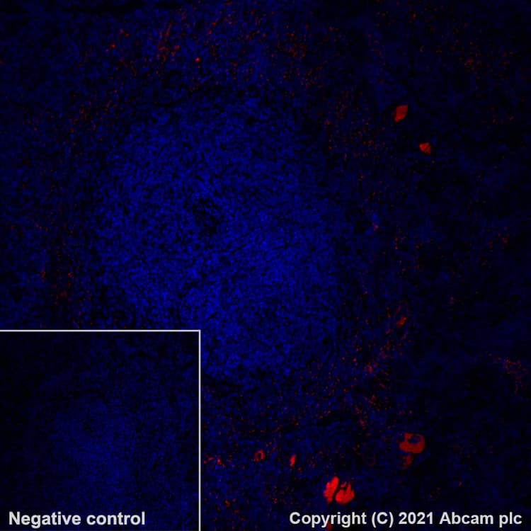 Alexa Fluor 647 Pf4 Antibody Epr7763 Ab280969  Immunohistochemistry Formalin Pfa Fixed Paraffin Embedded Sections Img134371